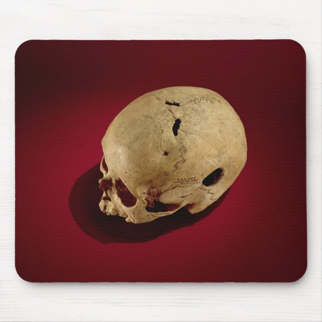 Trepanned Skull Mouse Mat (Front)