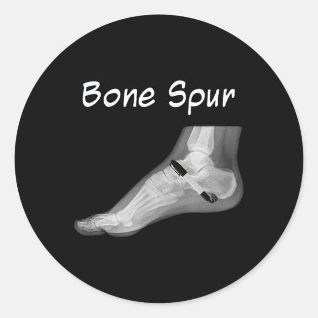 Trump Bone Spur Ink Pen Funny Anti Trump  Classic Round Sticker (Front)