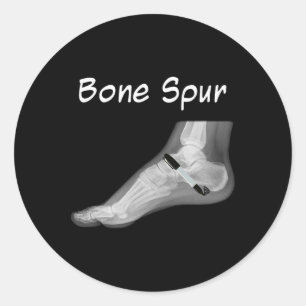 Trump Bone Spur Ink Pen Funny Anti Trump  Classic Round Sticker