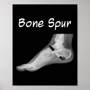 Trump Bone Spur Ink Pen Funny Anti Trump  Poster