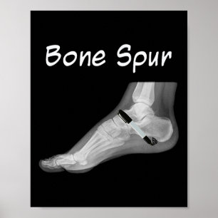 Trump Bone Spur Ink Pen Funny Anti Trump  Poster