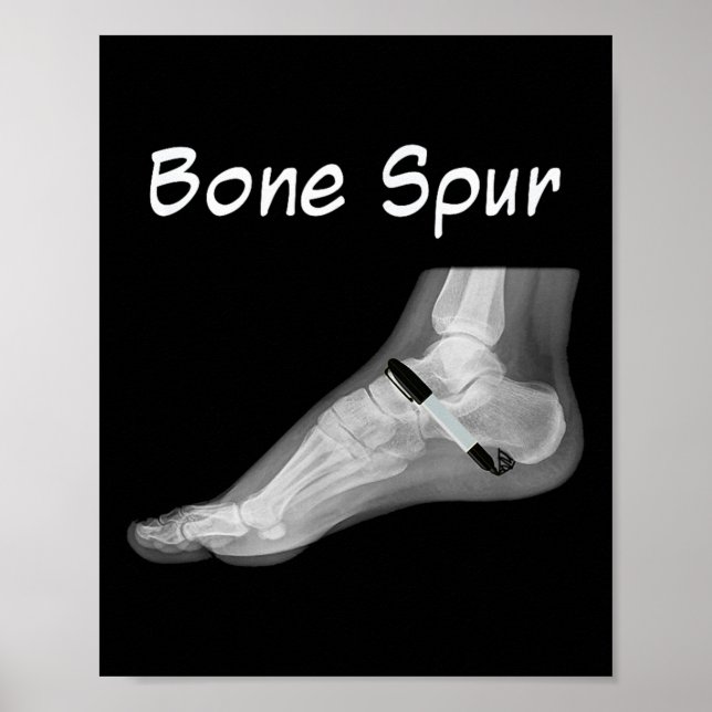 Trump Bone Spur Ink Pen Funny Anti Trump  Poster (Front)