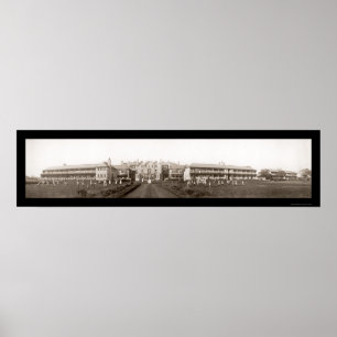 Tuberculosis Liverpool Photo 1912 Poster