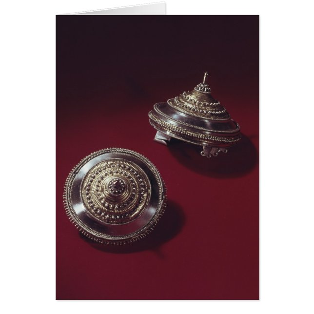 Tutulus fibular pair (Front)