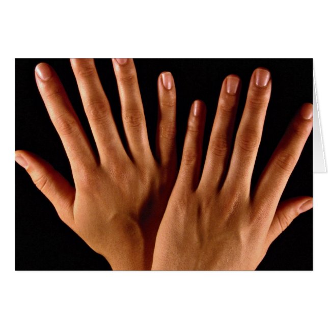 Two crossed hands (Front Horizontal)