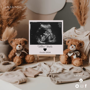 Two cute bears ultrasound pregnancy announcement
