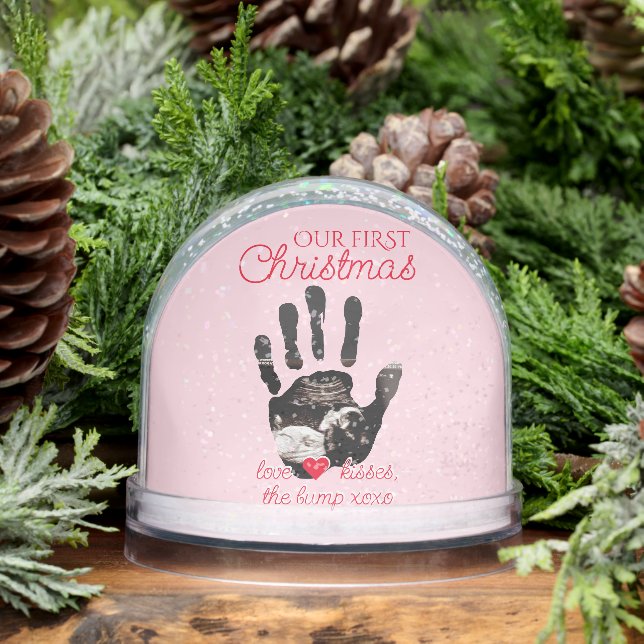 Ultrasound 1st Christmas Pregnancy Announcement Snowglobe (Winter)
