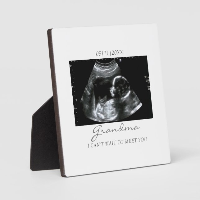 Ultrasound Gifts for Grandma Sonogram Baby Photo Plaque (Front)
