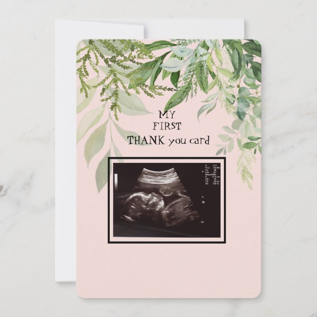 Ultrasound Girl Thank You Baby Point of View Card (Front)