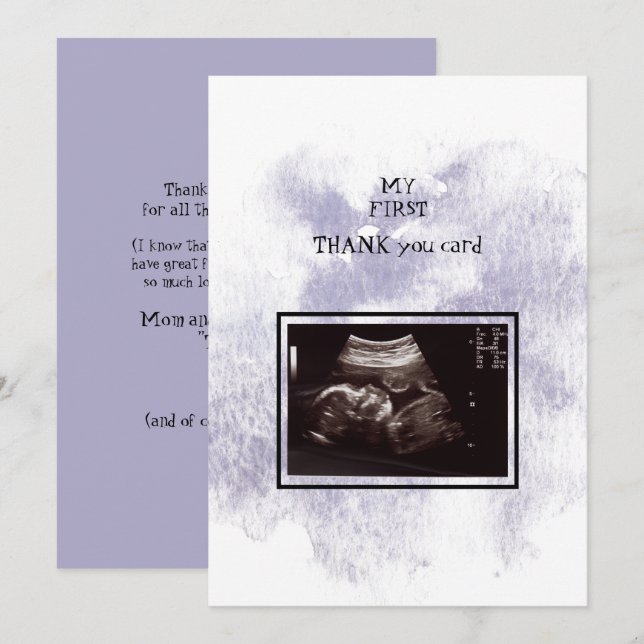 Ultrasound Girl Thank You Baby Point of View Card (Front/Back)