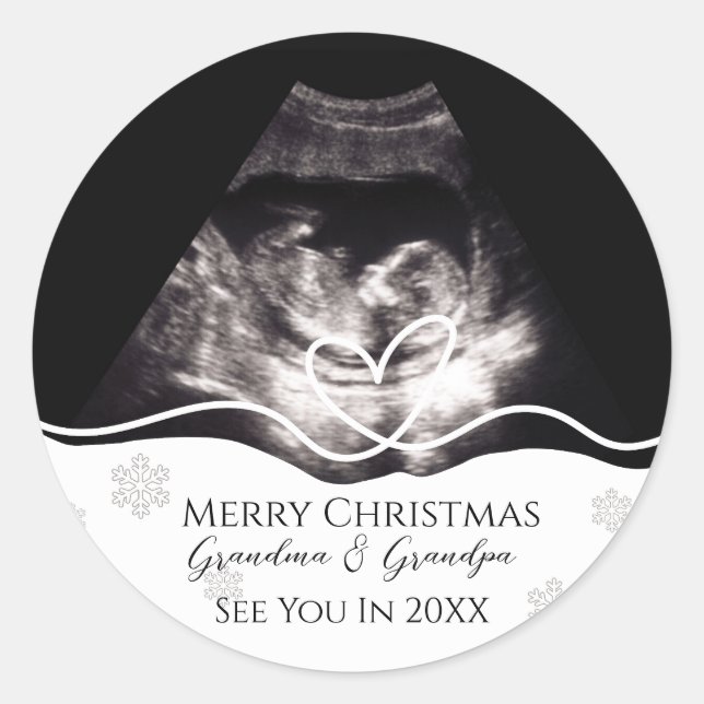 Ultrasound Grandparents Pregnancy Announcement Classic Round Sticker (Front)