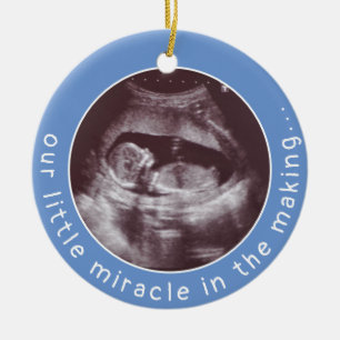 Ultrasound Photo Baby Boy Blue Miracle in Making Ceramic Tree Decoration
