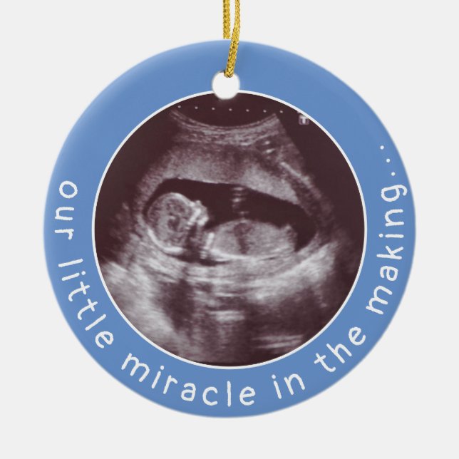 Ultrasound Photo Baby Boy Blue Miracle in Making Ceramic Tree Decoration (Front)