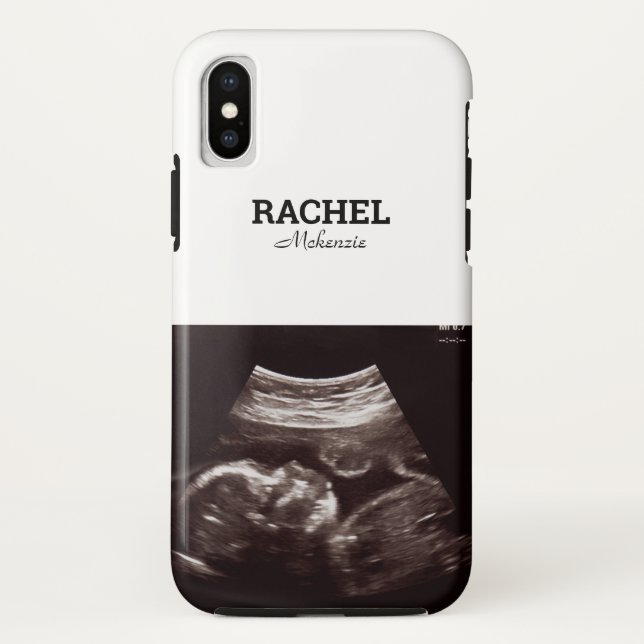 Ultrasound Photo Black and White Monogram Case-Mate iPhone Case (Back)