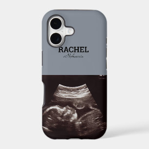 Ultrasound Photo Dusty Blue Monogram