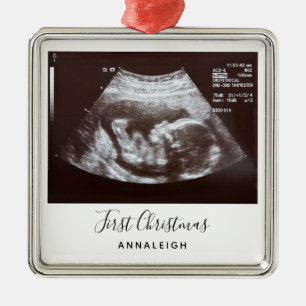 Ultrasound Photo First Christmas Holiday Pregnancy Metal Tree Decoration