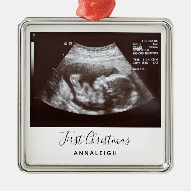Ultrasound Photo First Christmas Holiday Pregnancy Metal Tree Decoration (Front)