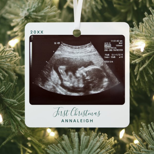 Ultrasound Photo First Christmas Sonogram Holiday Metal Tree Decoration (Insitu)