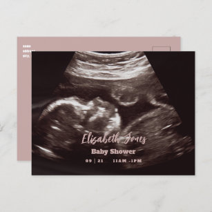 Ultrasound Photo Pink Baby Shower Announcement Postcard