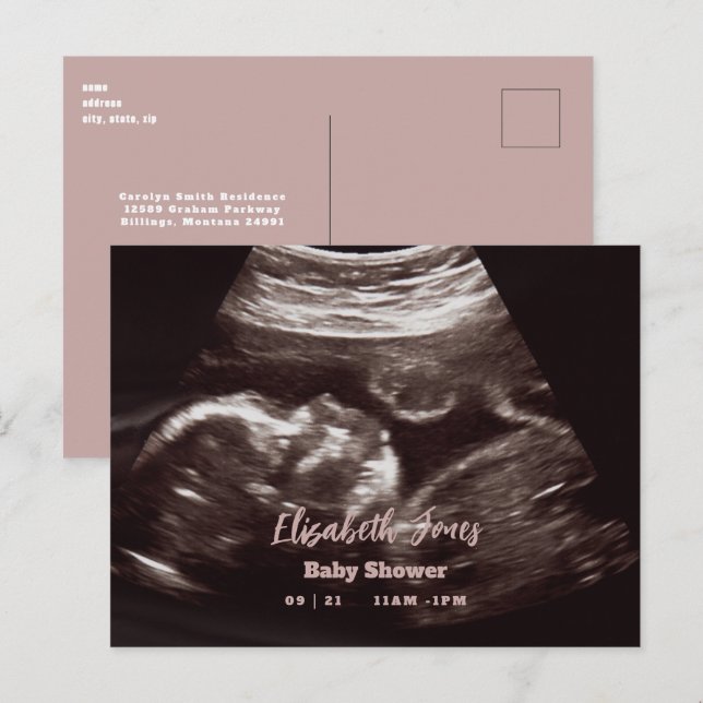 Ultrasound Photo Pink Baby Shower Announcement Postcard (Front/Back)