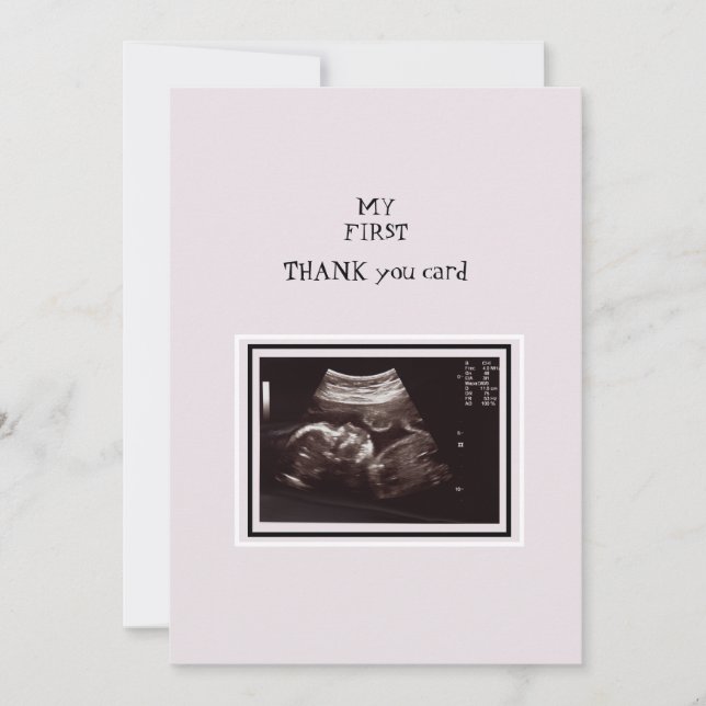 Ultrasound Photo Pink Thank You Baby Card (Front)