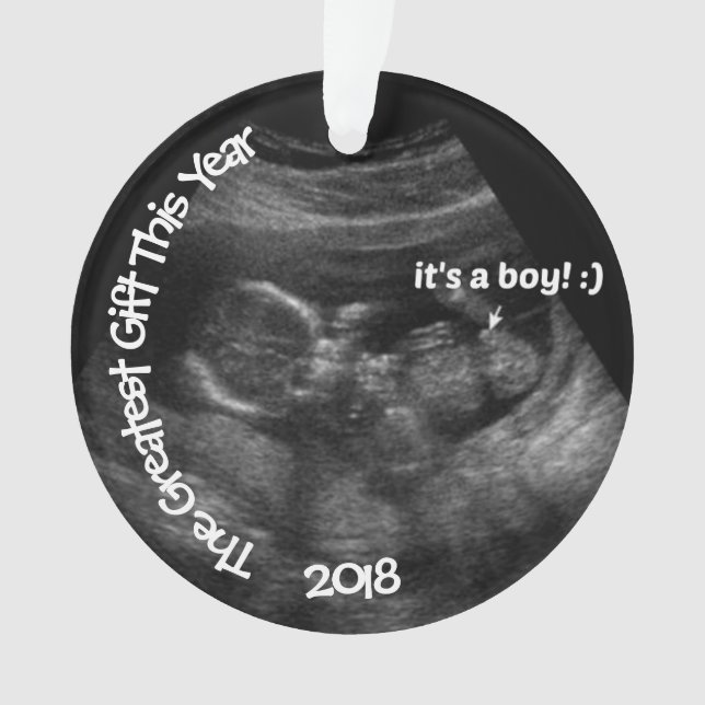 Ultrasound Photo Template CUSTOM Ornament (Front)