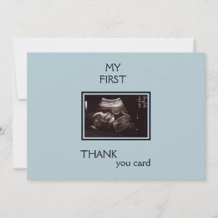 Ultrasound Photo Thank You From Baby Point of View Card