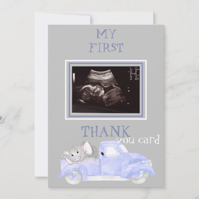 Ultrasound Photo Truck Thanks Baby Point of View Thank You Card (Front)