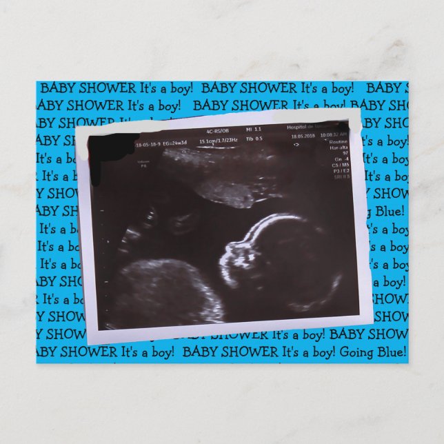 Ultrasound Picture Baby Shower Invitation Postcard (Front)
