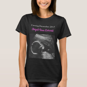 Ultrasound Picture Maternity Shirt for Boy or Girl