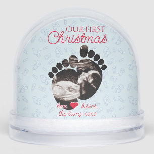 Ultrasound Pregnancy Announcement 1st Christmas Snowglobe