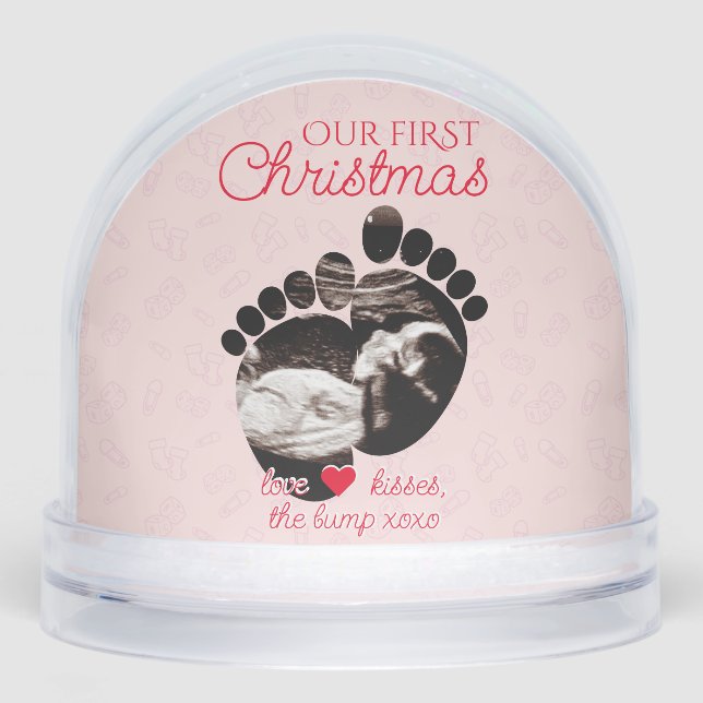 Ultrasound Pregnancy Announcement 1st Christmas Snowglobe (Front)