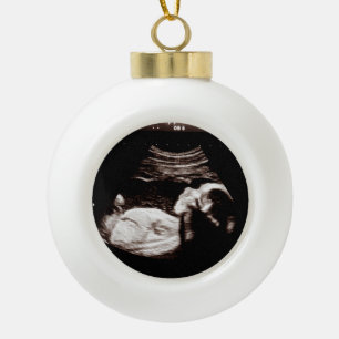 Ultrasound Pregnancy Announcement  Ceramic Ball Christmas Ornament