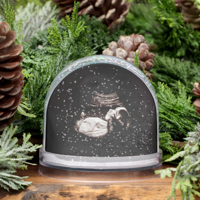 Ultrasound Snow Globe (Winter)