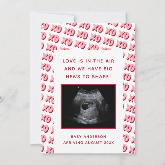 Valentine's Day Ultrasound Pregnancy Reveal  Announcement (Front)