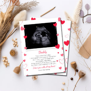 Valentines to Daddy From Bump