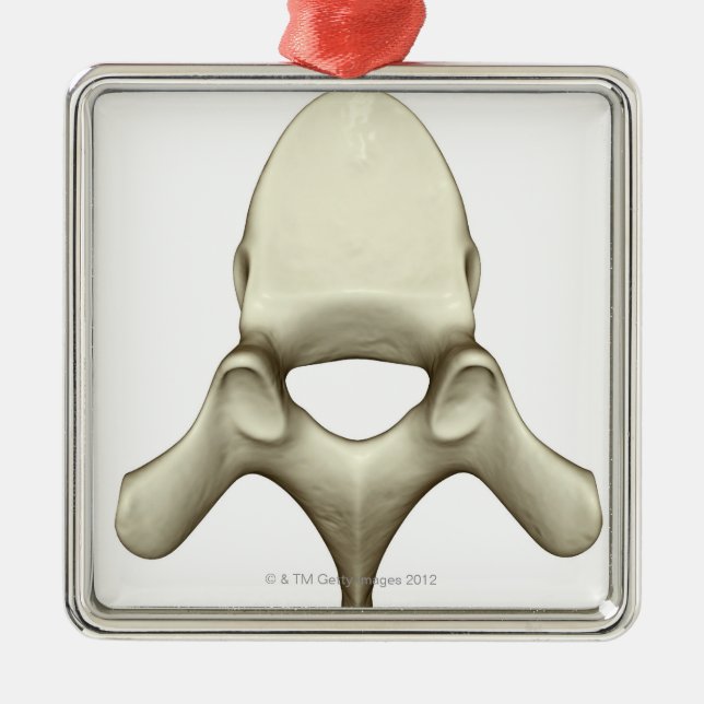 Vertebrae Metal Tree Decoration (Front)