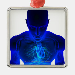 View from above of the layout of blood vessels metal tree decoration