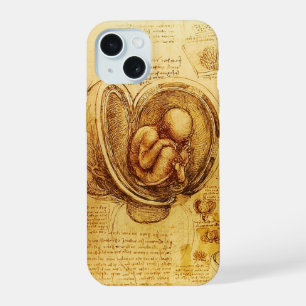 View of a Foetus in the Womb,Ob-Gyn Medical iPhone 15 Case