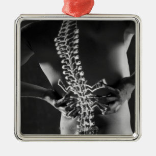 View of spinal chord metal tree decoration