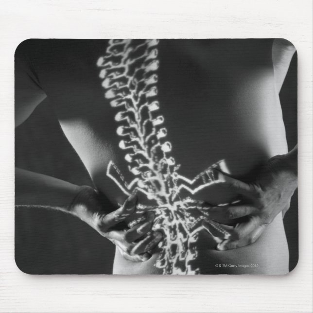 View of spinal chord mouse mat (Front)