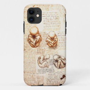 Views of a Foetus in the Womb,Ob-Gyn Medical iPhone 11 Case
