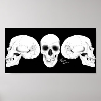 Views The Skull With The CIs Removed Poster