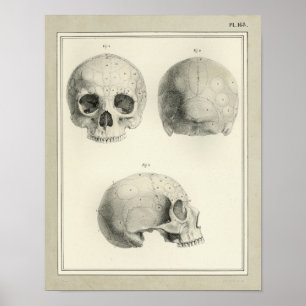 Vintage 1831 Human Skull Anatomy Print