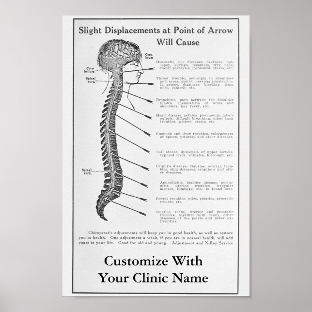 Vintage 1921 Chiropractic Ad Art Poster Customize (Front)