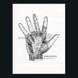 Vintage Anatomy Art The Palm of the Hand Poster<br><div class="desc">This black and white anatomy illustration features muscles of the palm of the hand.</div>