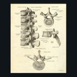 Vintage Anatomy Print Bones Lumbar Vertebra<br><div class="desc">Vintage anatomy print restored with uniform background to match the other prints from the series available here on zazzle.</div>