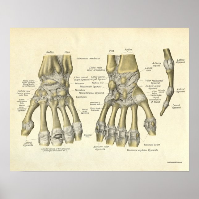 Vintage Anatomy Print Bones of Hand Wrist (Front)