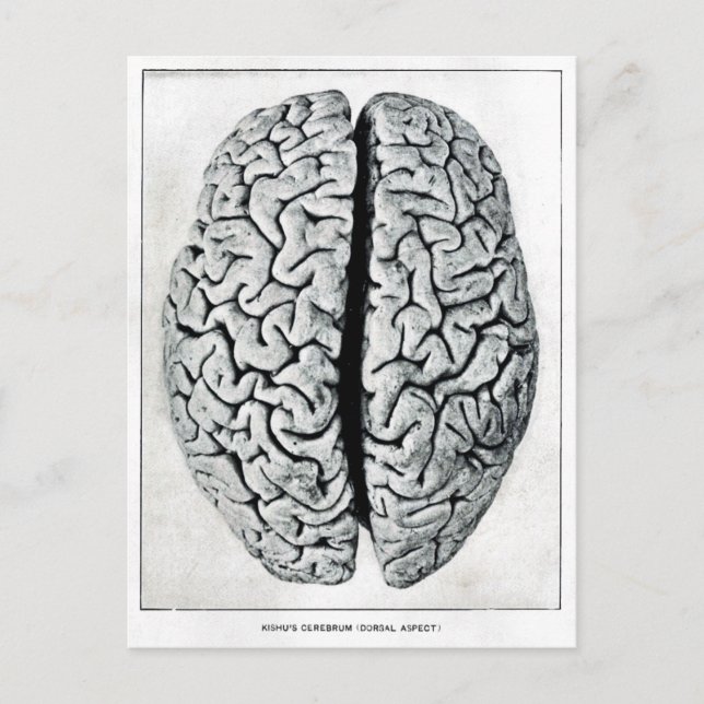 Vintage Brain Postcard (Front)