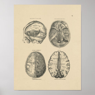 Vintage Brain Skull Anatomy 1880 Print